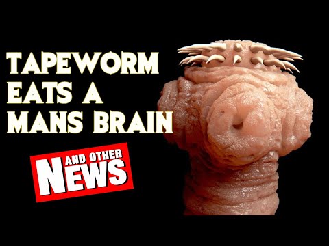 Giant Tapeworm Eats Mans Brain (And Other News)