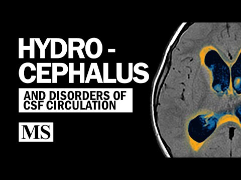 Hydrocephalus And the Disorders of CSF Circulation