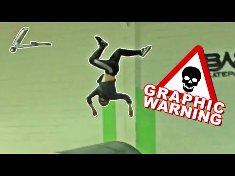 WORST SCOOTER FAILS OF 2018 *GRAPHIC WARNING*