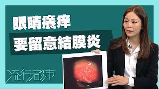 流行都市｜眼睛癢痒 要留意結膜炎｜結膜炎｜眼睛