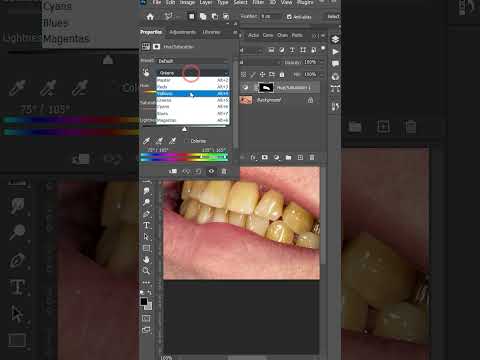 How to Whiten teeth in #photoshop #shortsfeed #shorts #adobephotoshope #tutorial