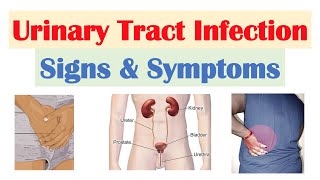 Urinary Tract Infection (UTI) Signs & Symptoms (& Why They Occur)