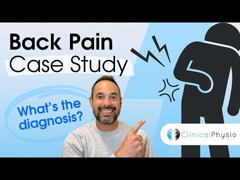 Back Pain Case Study | Expert Physio guides you through assessment clinical reasoning and diagnosis!