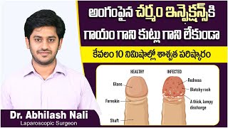 అక్కడ ఇన్ఫెక్షన్ కి 10నిం||లో | Painless Circumcision for Diabetic Foreskin Infections | Dr Abhilash