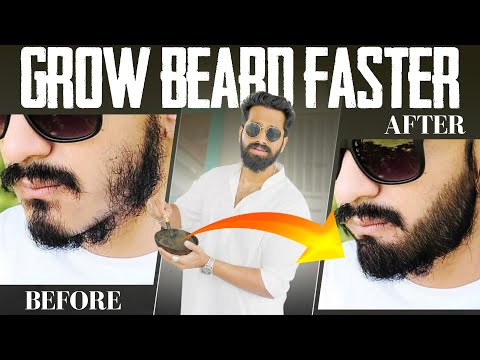 5 Ways To Grow *PATCHY BEARD* For TEENS