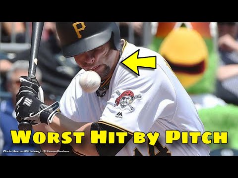 MLB | Worst Hit By Pitch OMG