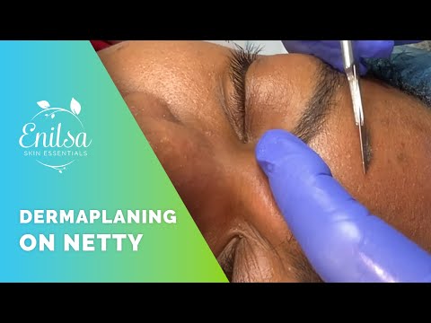 Dermaplaning Treatment on Netty - Walkthrough + Tips