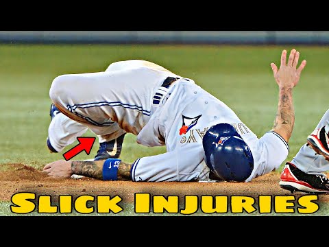 MLB | Slick injuries V13