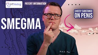 Doctor Explains SMEGMA | White / Yellow Cheesy Substance on your Penis | Treatment and Prevention