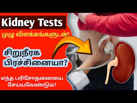 சிறுநீரக பிரச்சினையா?/இந்த Test செய்தீங்களா?/Do you have kidney problem/kidney failure test in tamil