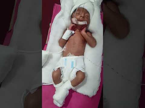 #newbornbaby #babycutemoment #babysleep #babysleepingsongs #babyshorts #baby #cute #lovely #shorts