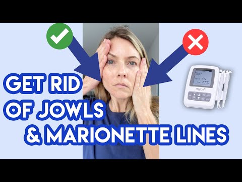 How to Treat Jowls and Marionette Lines At Home | Mature Skin