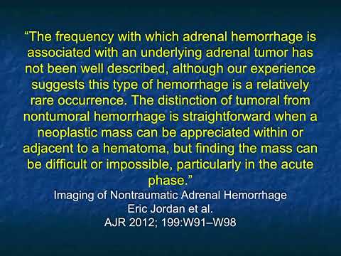 CT Evaluation of Adrenal Hemorrhage: A Challenging Diagnosis? - Part 1