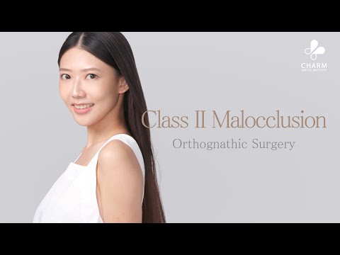 Orthognathic Surgery Class II Malocclusion