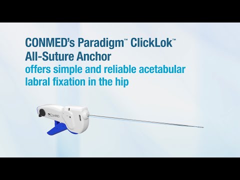 Paradigm™ ClickLok™ All-Suture Anchor - CONMED Product Video