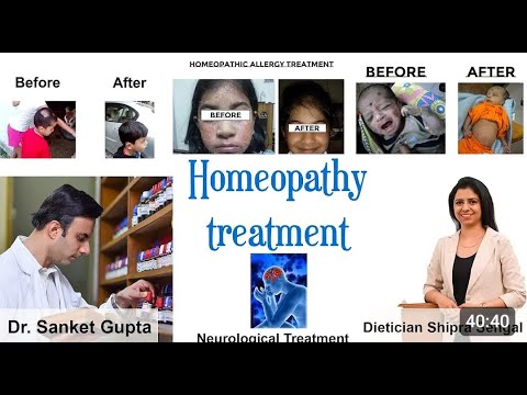 All about Homoeopathy with Dr. Sanket Gupta of AKGsOVIHAMS