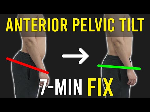 Fix The Anterior Pelvic Tilt｜Excessive Lower Back Arch, Pain｜Corrective Excercises