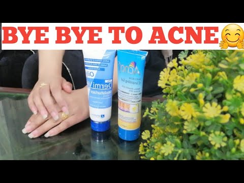 BEST "ACNE TREATMENT" OF BOYS AND GIRLS| VISIBLE RESULT IN FEW WEEKS