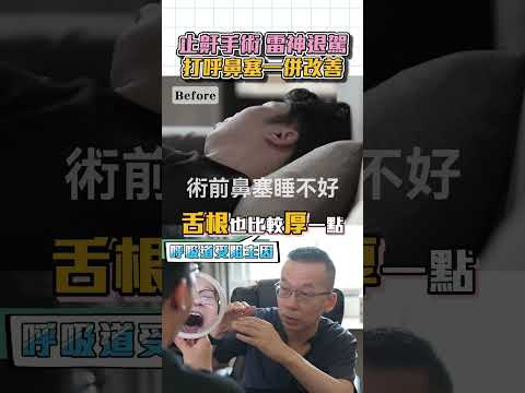 高雄止鼾手術改善打呼打鼾症狀 高雄永恆醫美整形 Dr.何旭爵醫師 #高雄止鼾手術 #高雄打呼手術 #高雄打鼾手術