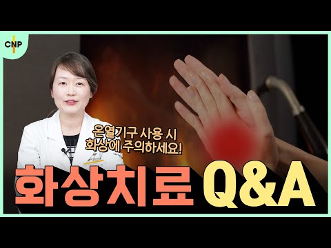 피부 화상! 초기 대처법 부터 치료 방법까지 한번에 알려드립니다!