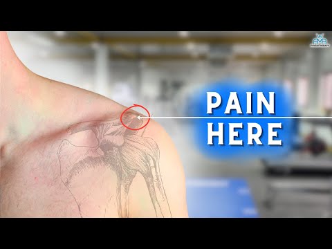 5 BEST AC Joint Rehab Exercises!