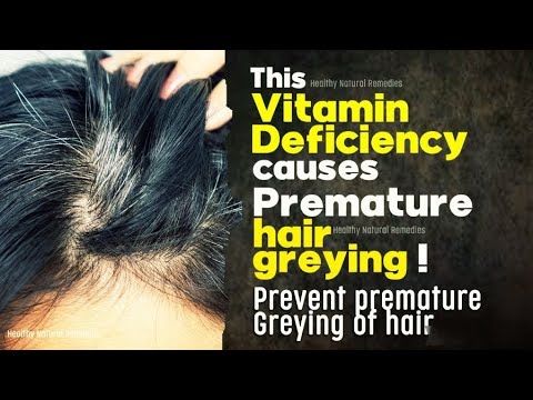 This Vitamin Deficiency causes premature hair greying | Prevent premature hair greying | Hair loss