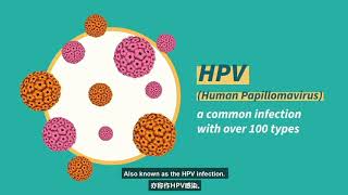 Cervical Cancer Screening (Pap test / HPV test)