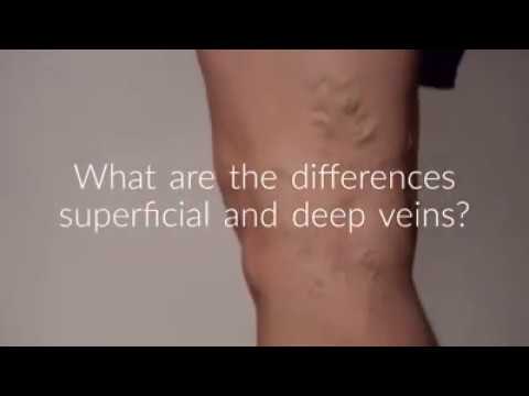 The Difference Between Superficial and Deep Veins