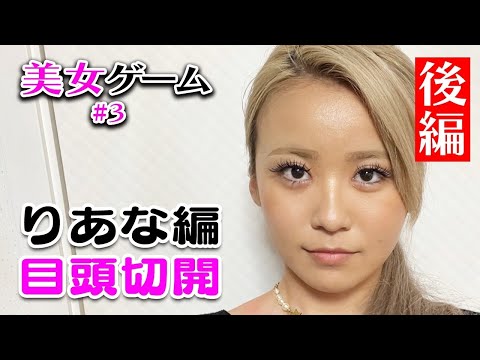 【美女ゲーム #3 】eggりあなが目頭切開に挑戦！術後経過大公開♡【美容整形】湘南美容クリニック