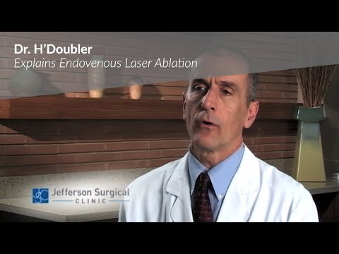 Dr. H’Doubler Explains Endovenous Laser Ablation