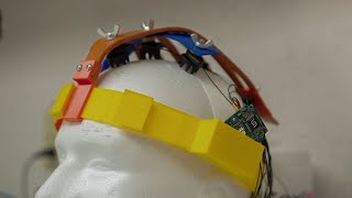 Brain computer interface technology at the Glenrose Rehabilitation Hospital