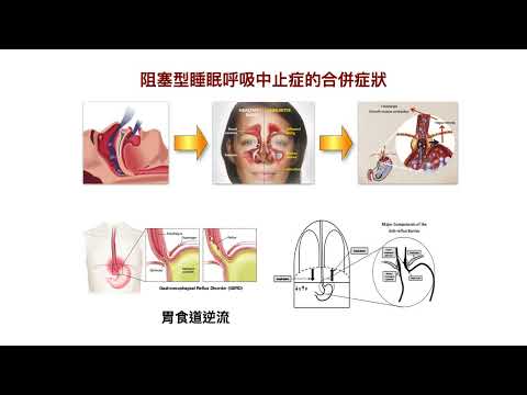 20221214 醫工學系 臨床醫療概論 睡眠呼吸