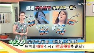 病危非插管不可？搞懂什麼是插管！健康2.0(完整版)