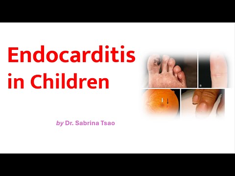 Endocarditis in Childhood by Dr Sabrina Tsao - 9 Oct 2024