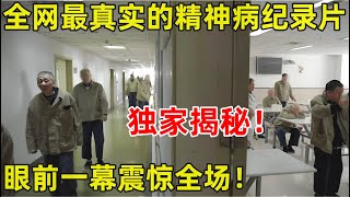 全网最真实的精神病患者记录!精神病院实拍,看起来跟正常人一样,发起病来千奇百怪!【生命的故事】