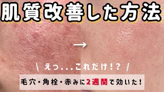 【たった1つのアイテムで！】肌質改善のために実践したこと教えます【混合肌で敏感肌】