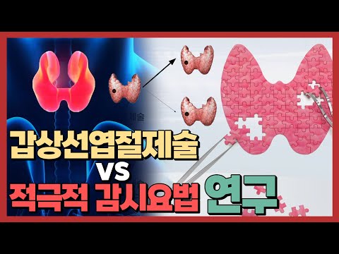 갑상선엽절제술 VS  적극적 감시요법 연구