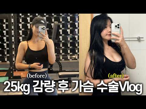 25kg 감량 후 결심한 가슴 수술 Vlog💥 [이수2Vlog]