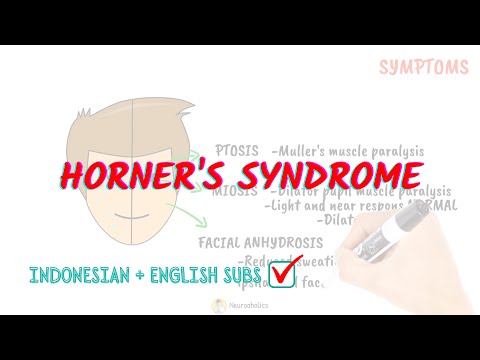 Horner's syndrome pathophysiology | Neuroaholics