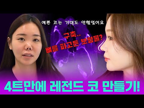 실리콘이 안으로 파고 들었다고..?😱 4번째 구축코👃 극복 Vlog [두민Vlog]