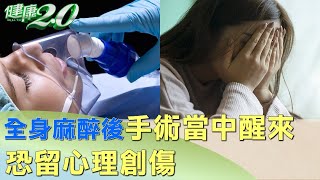 全身麻醉手術過程當中醒來 恐留心理創傷 健康2.0