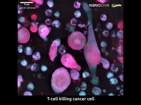 T Cells Killing cancer Cells