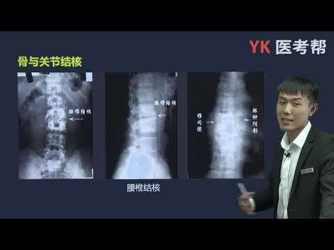 第六十九章 骨与关节结核 02 脊柱结核（影像学检查、鉴别诊断及治疗）、髋关节结核、膝关节结核