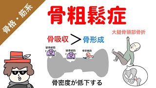 【国試対策】骨粗鬆症のメカニズム（解剖生理〜疾患）