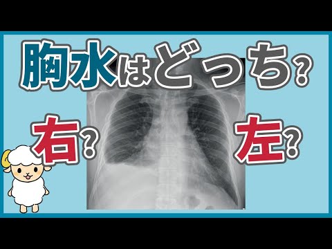 胸水のレントゲンを徹底解説【動画内で読めるようになります】