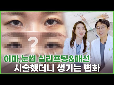 이마거상&눈썹거상 매선침과 실리프팅 시술을 하면 생기는 변화?!