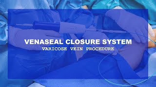 VENASEAL CLOSURE SYSTEM | VARICOSE VEIN PROCEDURE | Paul Davis, M.D. - MVI TV