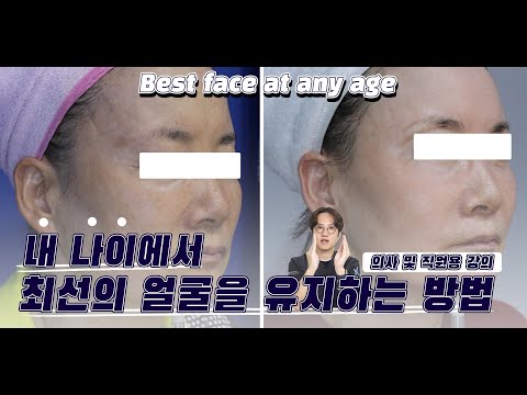 내 나이에 최선의 얼굴을 만드는 법(의사/직원 내부교육용) ^^