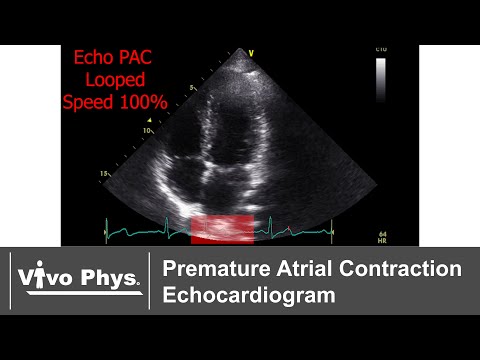 PAC Echo Parasternal and Apical Views