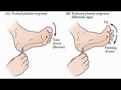 Primitive Reflexes Part 1